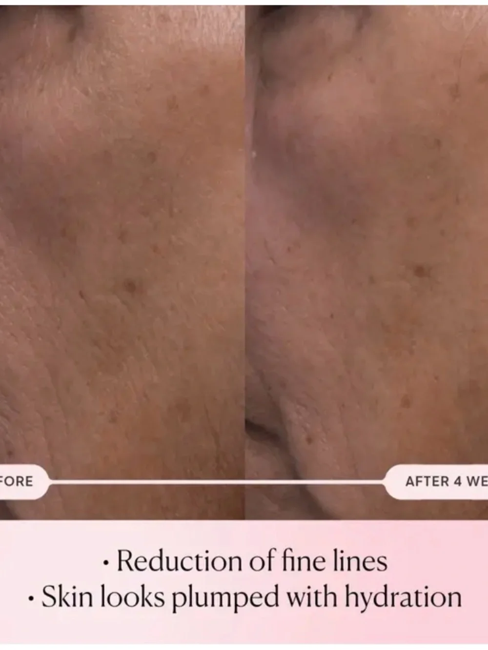 ELEMIS pro collagen